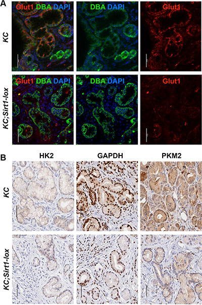 Expression of glycolytic proteins in murine SIRT1-deficient PanIN lesions.