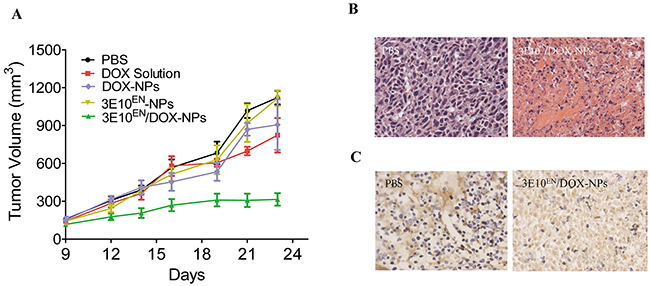 3E10EN/DOX-NPs have a significant effect on tumors.