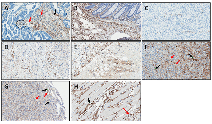 Examples of immunohistochemical detection of endosialin/TEM-1 in a subset of malignant and normal tissues.