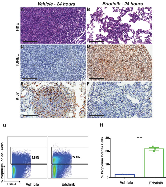 Erlotinib treatment-induced apoptosis in EGFR