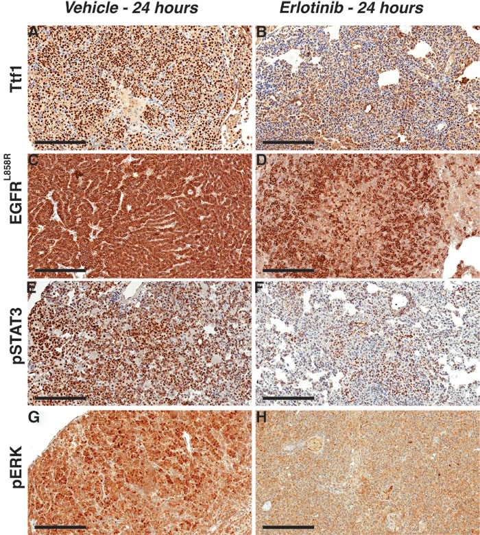 Figure 5 : Erlotinib treatment triggers rapid response by decreasing survival signals in EGFR