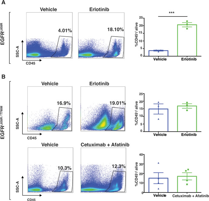 Immune profiling demonstrated increased leukocyte infiltration in EGFR