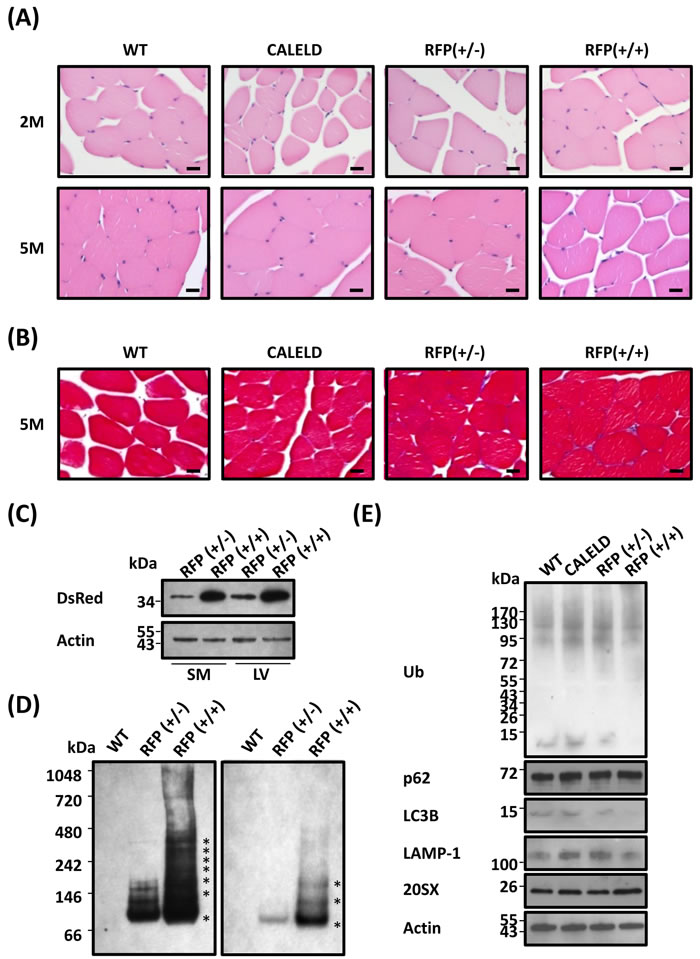 RFP aggregation in skeletal muscles without causing myopathy.