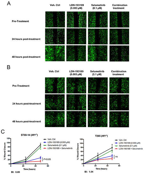 Selumetinib enhances the anti-migratory effects of LDN-193189 in MPNST cells.