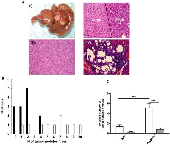 DEN-induced liver alterations according to Per2 loss-of-function found on day 178.