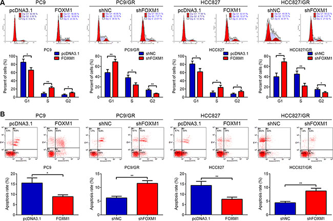 FOXM1 promoted cell proliferation and inhibited apoptosis in lung adenocarcinoma cells upon gefitinib treatment.