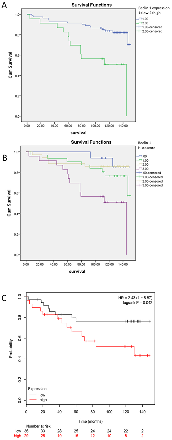 Kaplan-Meier survival analysis of Beclin 1 expression in patients with ER-positive breast cancer.
