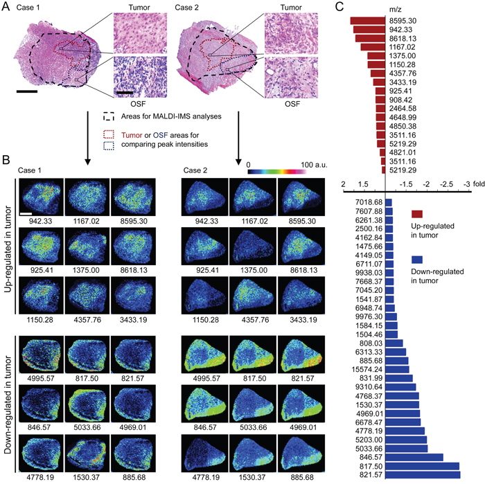 Altered peptide peaks identified by MALDI-IMS.