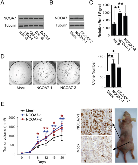 Overexpression of NCOA7 induces proliferation in OSCC cells.