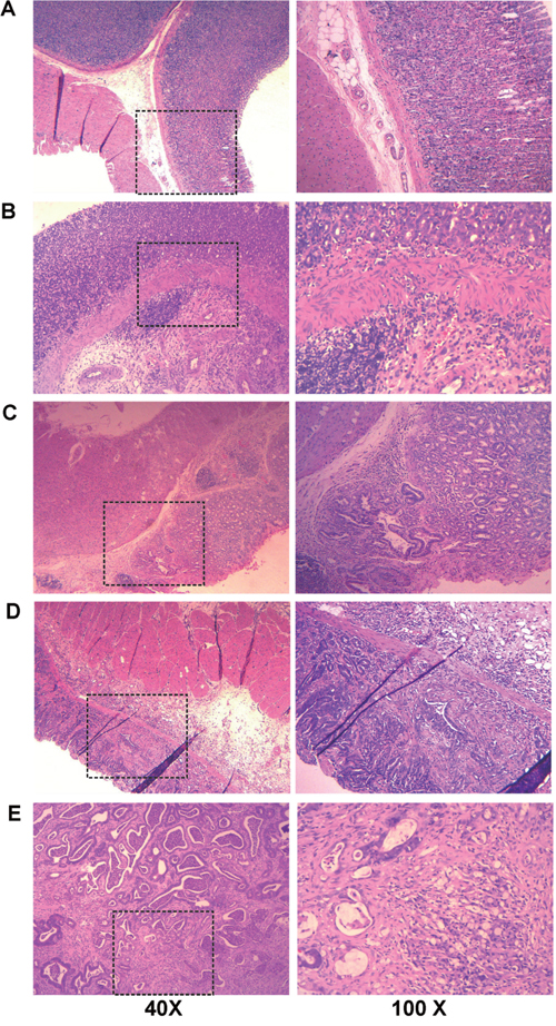 Representative histology images from gastric biopsies for normal rats (CON) and rats in four typical pathological stages (MODEL).