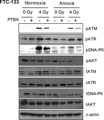 Under anoxia, genetic inhibition of PI3K inhibits radiation-induced ATM and DNA-PKcs activation.