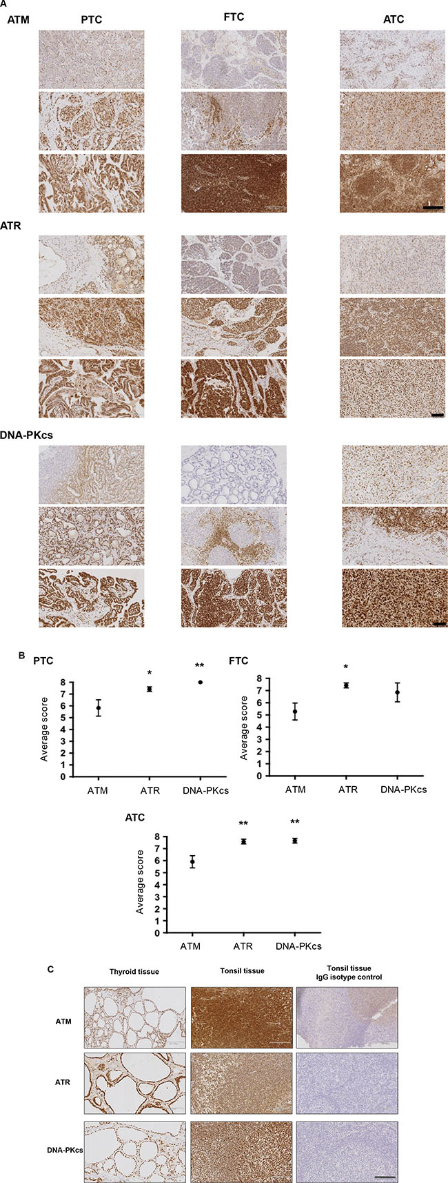 The PIKKS are a viable target in human thyroid cancer.