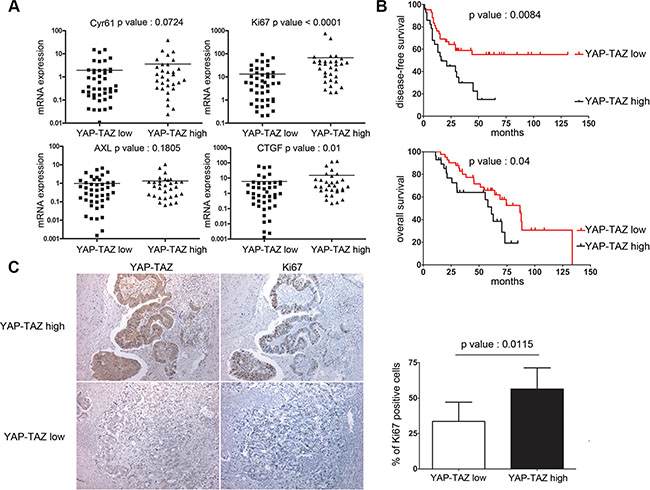 YAP/TAZ levels in liver metastases are highly correlated with Ki-67 and tumor relapse in colon cancer patients.