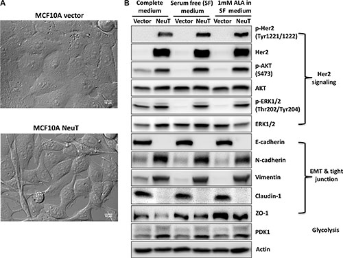 Her2/NeuT oncogene expression transformed MCF10A human breast epithelial cells.