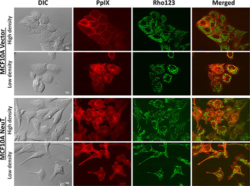 NeuT oncogene transformation altered ALA-induced PpIX intracellular localization from being cell contact-dependent membrane localization to being mitochondrial localization independent of cell density.