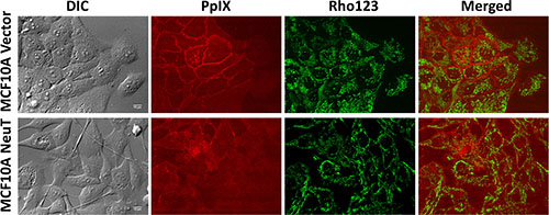 Exogenous PpIX showed cell contact-dependent membrane localization in MCF10 A vector cells, but not in the NeuT cells.