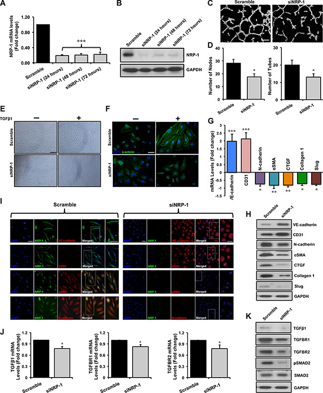 Loss of NRP-1 inhibits TGF&#x03B2;1- induced EndMT in HUVECs.
