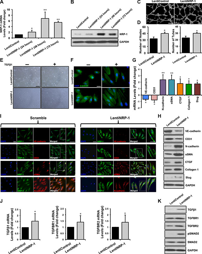 Lentivirus-mediated NRP-1 overexpression exacerbates TGF&#x03B2;1-induced EndMT in HUVECs.