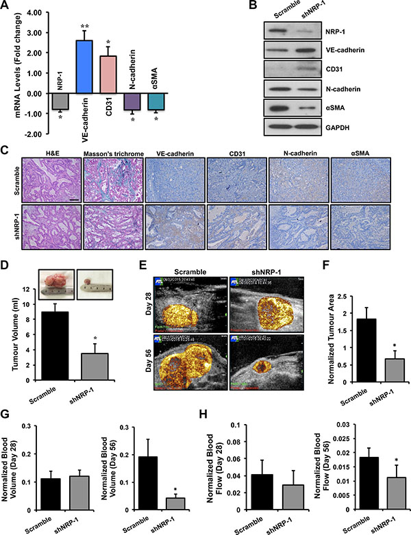 Loss of NRP-1 inhibits EndMT and fibrosis in vivo and results in reduced tumor growth.
