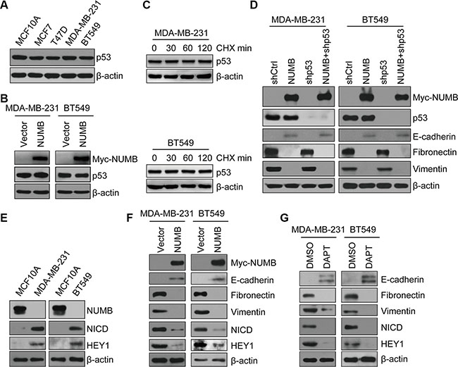 NUMB negatively regulates EMT of TNBC in a Notch-dependent and p53-independent manner.