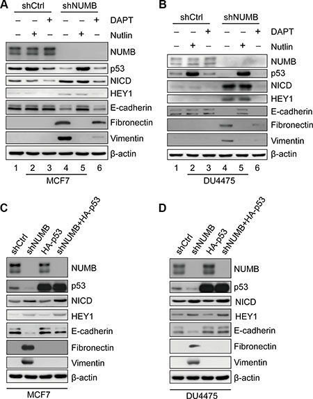 The p53 pathway plays a major role in NUMB-mediated EMT in breast cancer cells expressing wild-type p53.
