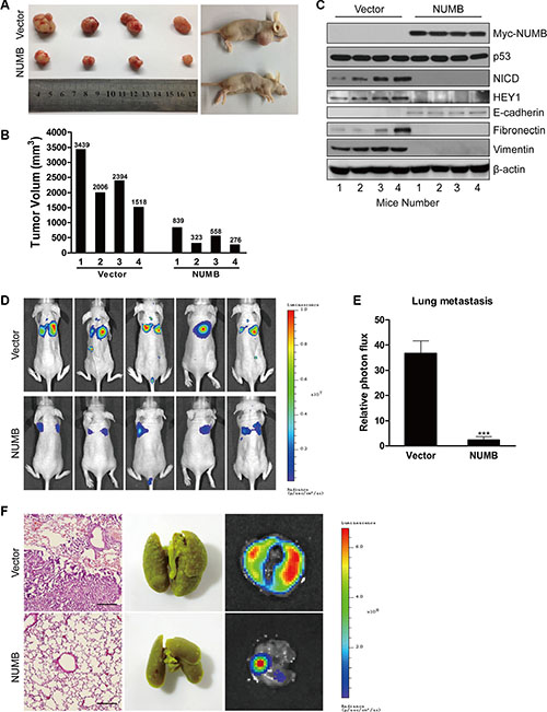 NUMB overexpression suppresses tumor growth and metastasis of TNBC cells in vivo.
