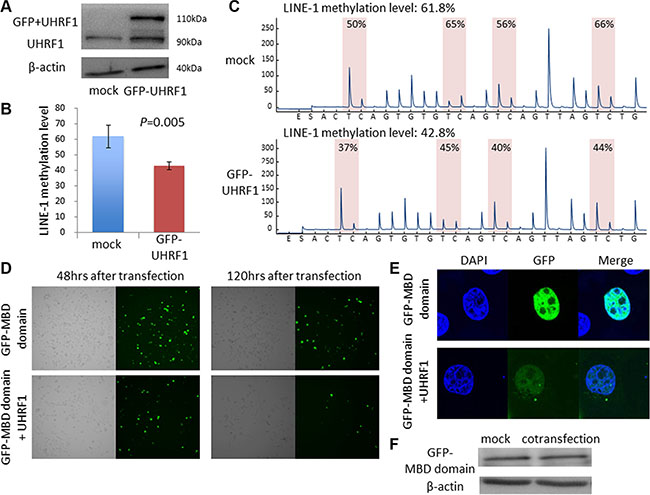Vector-mediated UHRF1 overexpression caused DNA hypomethylation in ESCC cell lines.