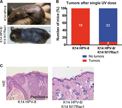 Epidermis specific inhibition of Rac1 attenuates UV-light induced skin tumor formation in K14 HPV-8 mice.