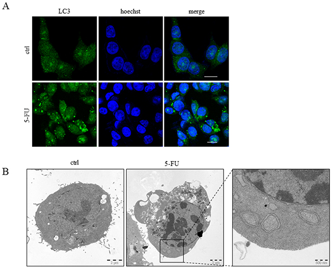 Autophagy is induced by 5-FU in HCT116 cells.