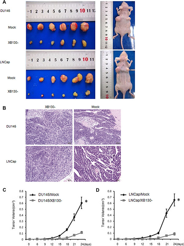 XB130 downregulation inhibited prostate cancer growth in vivo.