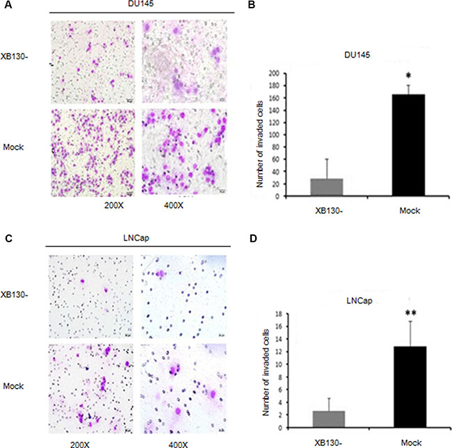 Reduced XB130 expression attenuated invasiveness of prostate cancer.