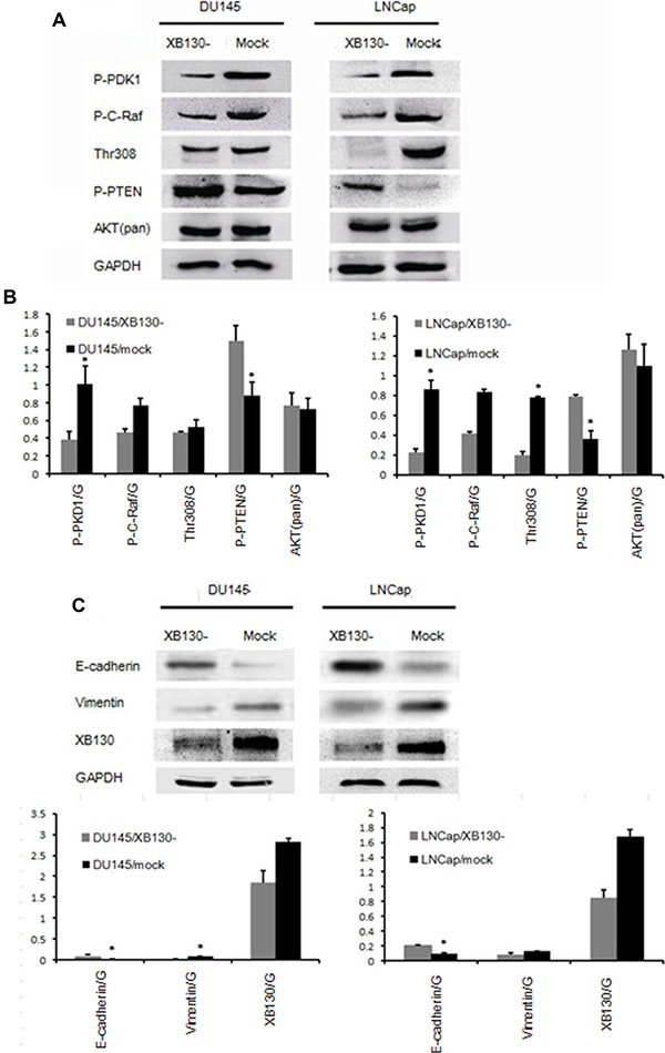 XB130 was involved in both Akt signaling and EMT process.