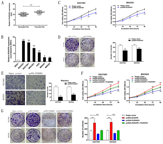 Down-regulation of PLEKHO1 promotes GC cell proliferation and is involved in the oncogene function of DUXAP8.