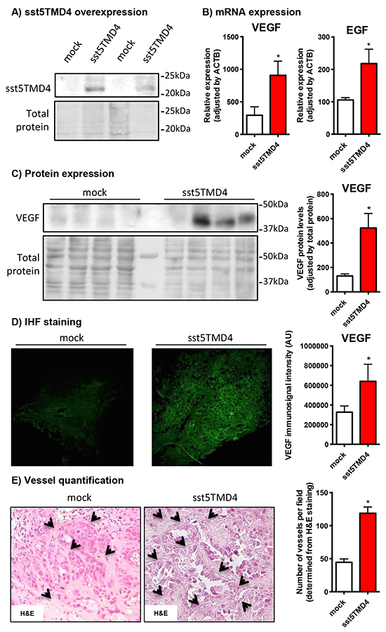 sst5TMD4 overexpression increases the expression of pro-angiogenic factors and the number of blood vessels in xenografted breast cancer cell line-derived tumors.