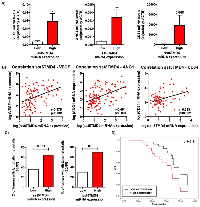 sst5TMD4 expression is associated to higher expression of pro-angiogenic factors and the presence of lymphatic metastasis in breast cancer samples.