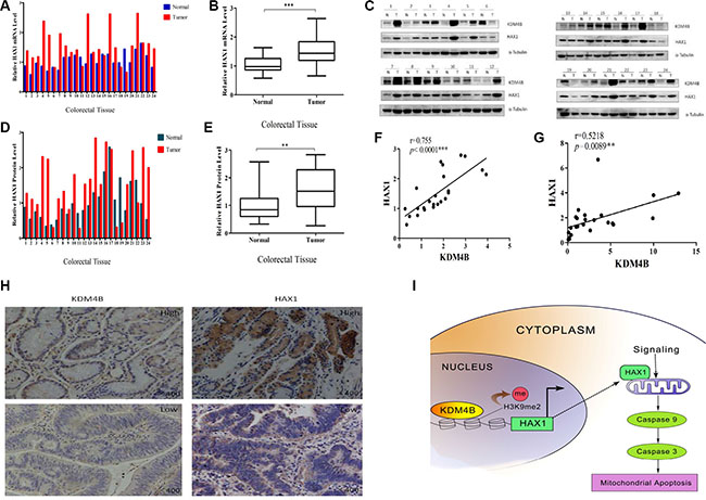 KDM4B and HAX1 expression are significantly correlated in colorectal tissues.