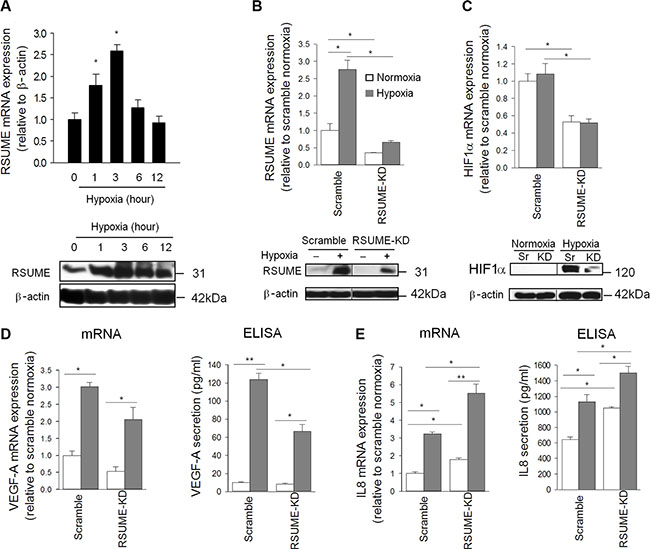 Influence of RSUME on HIF-1&#x03B1;, VEGF-A and IL-8 production.