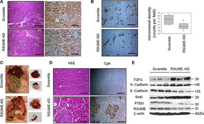 Role of RSUME in an orthotopic neuroendocrine pancreatic tumor model.