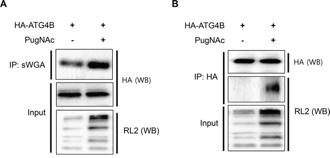 ATG4B is O-GlcNAcylated in PugNAc-treated cells.