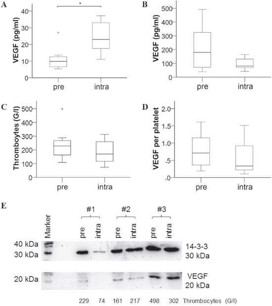 Assessment of VEGF content in platelets of mCRC patients before and after bevacizumab therapy.