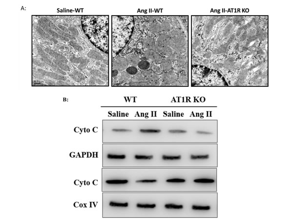 AT1R deletion attenuated Ang II-induced mitochondrial dysfunction