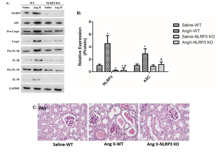 NLRP3 deletion inhibited NLRP3 inflammasome activation and maintains mitochondrial homeostasis.