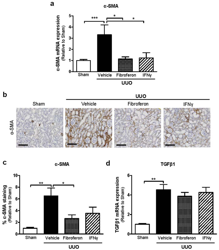 Fibroferon reduces &#x3b1;-SMA expression in mouse UUO kidneys.