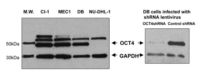 Western blot detection of OCT4 in leukemia/lymphoma cell lines expressing MIAT with different abundance.