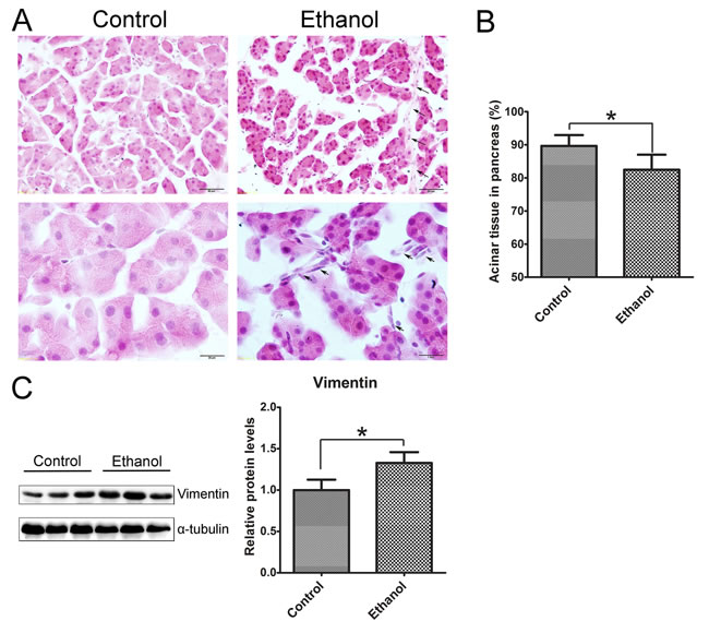 Binge ethanol exposure-induced histological alterations in the pancreas.