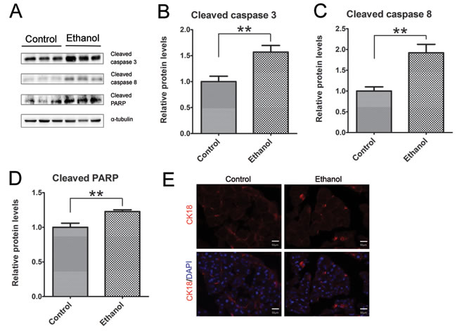 Binge ethanol exposure-induced apoptosis in the pancreas.