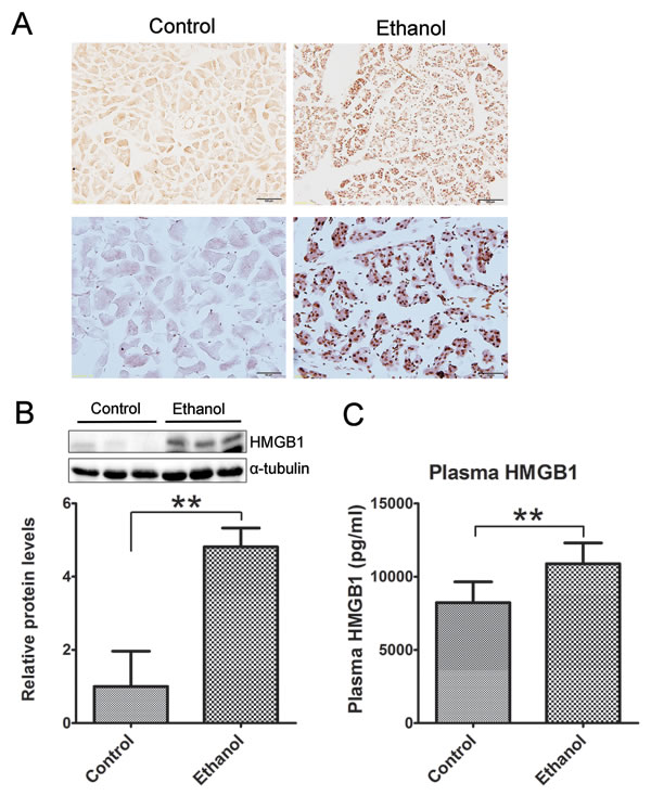 Effect of binge ethanol exposure on HMGB1 expression in the pancreas.