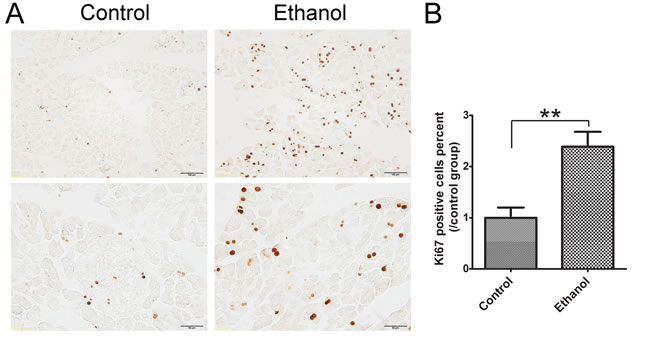 Effect of binge ethanol exposure on cell proliferation in the pancreas.