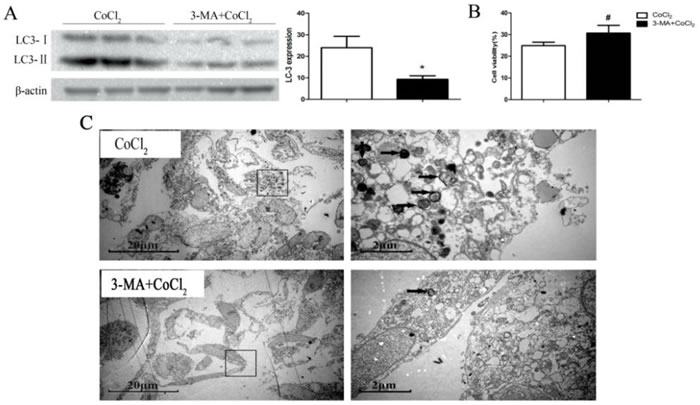 Autophagy inhibitor 3-MA inhibits HK-2 cell death by CoCl