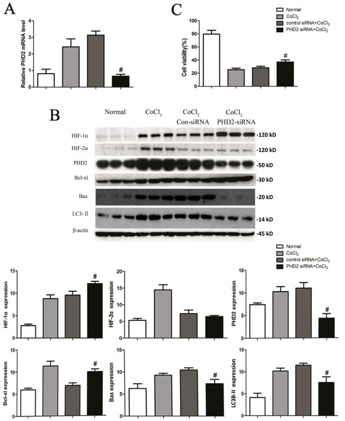PHD2 silencing in HK-2 cells attenuates apoptosis and autophagy by CoCl